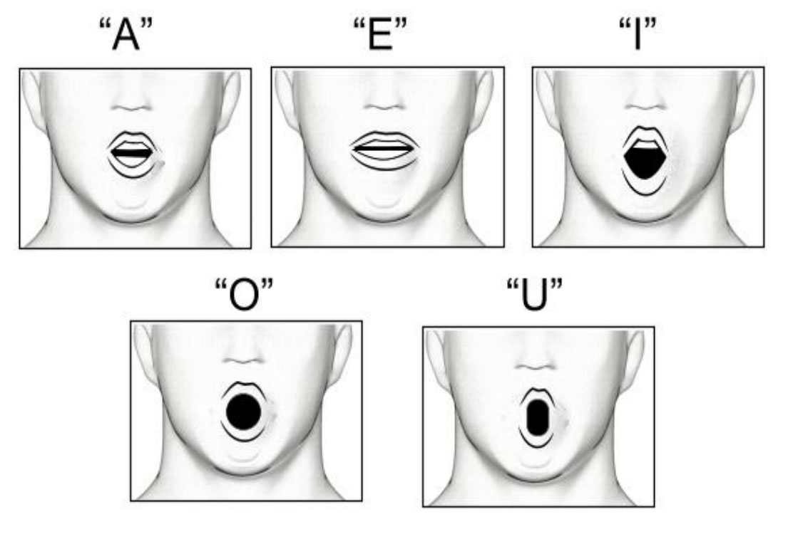 Vowel pronunciation to improve OSA 