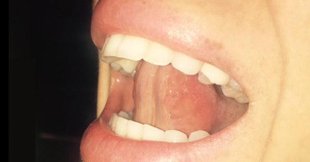 A women's mouth with her tongue placed behind her teeth on the roof of her mouth