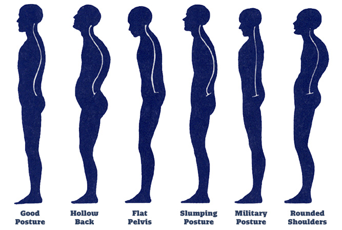 Different spinal alignments after good posture infographic